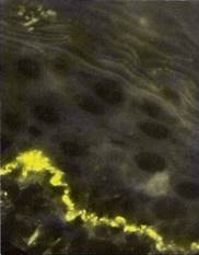 IgG